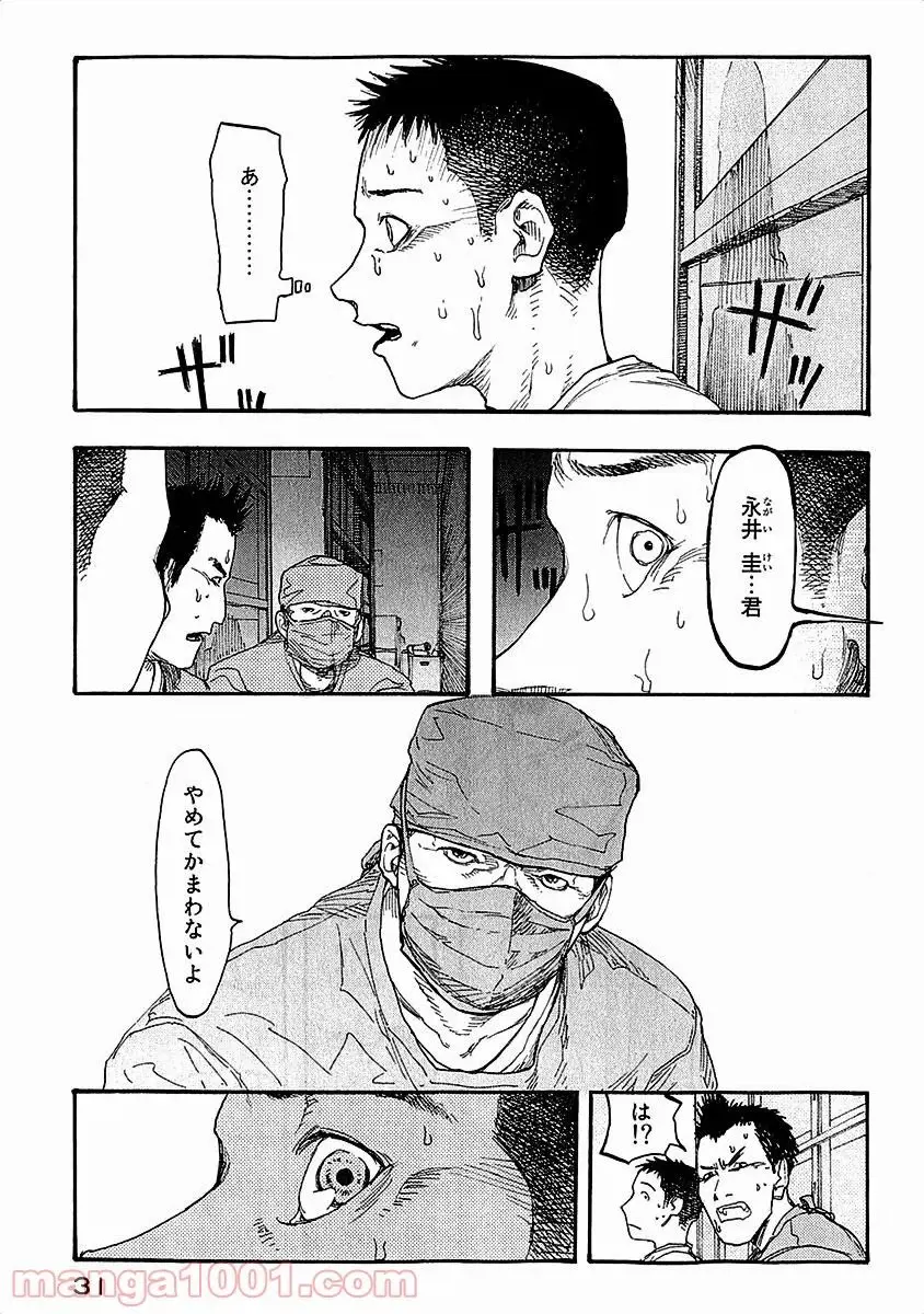 31