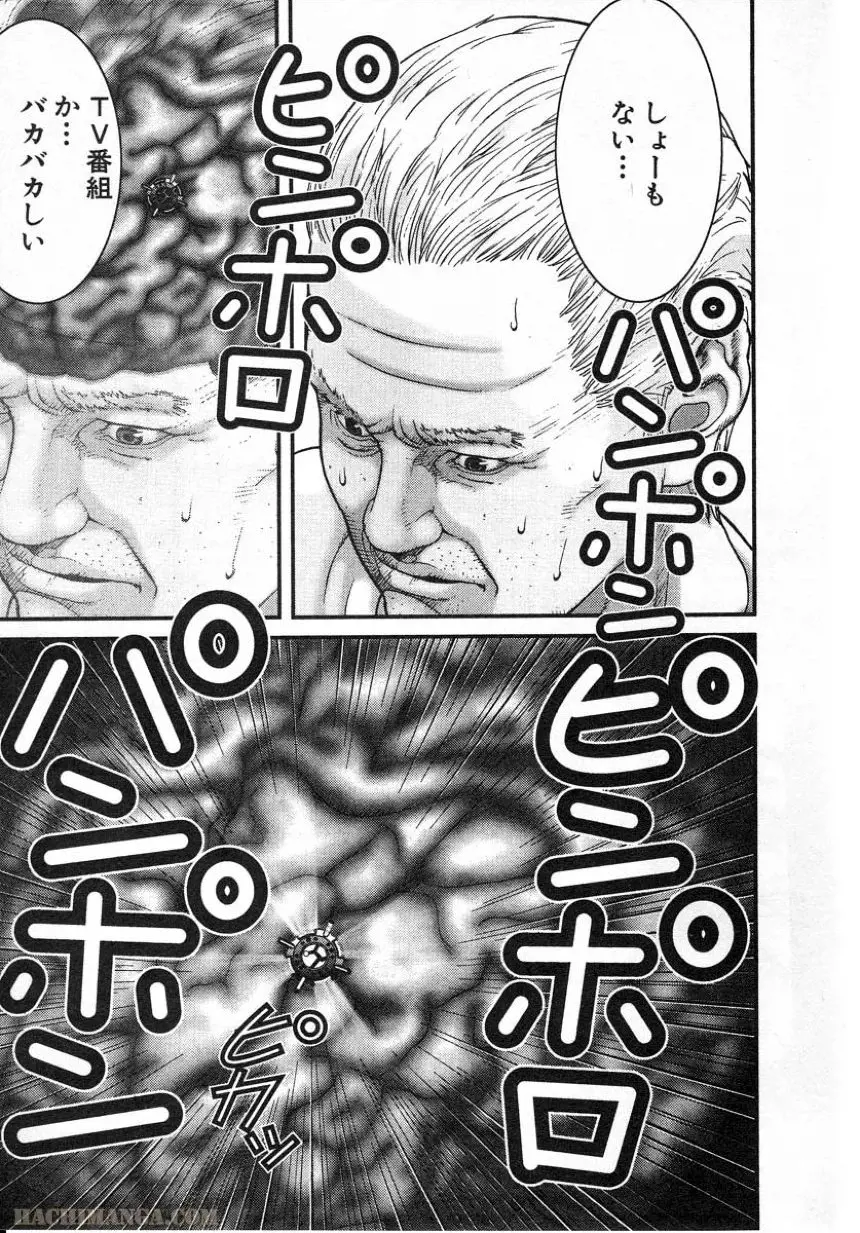 151